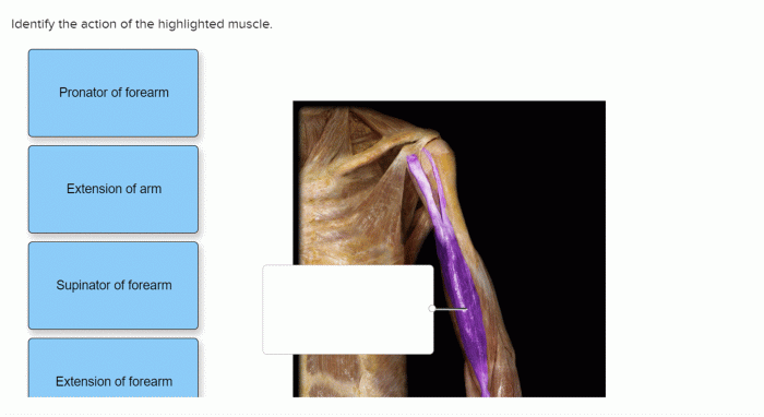 Highlighted muscle proprofs