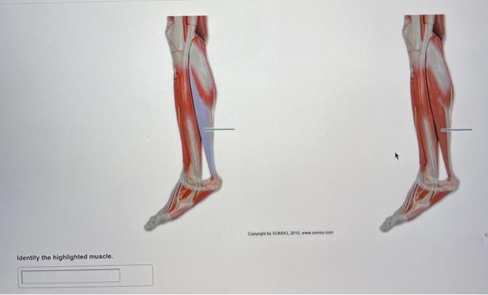 Identify the highlighted muscle leg